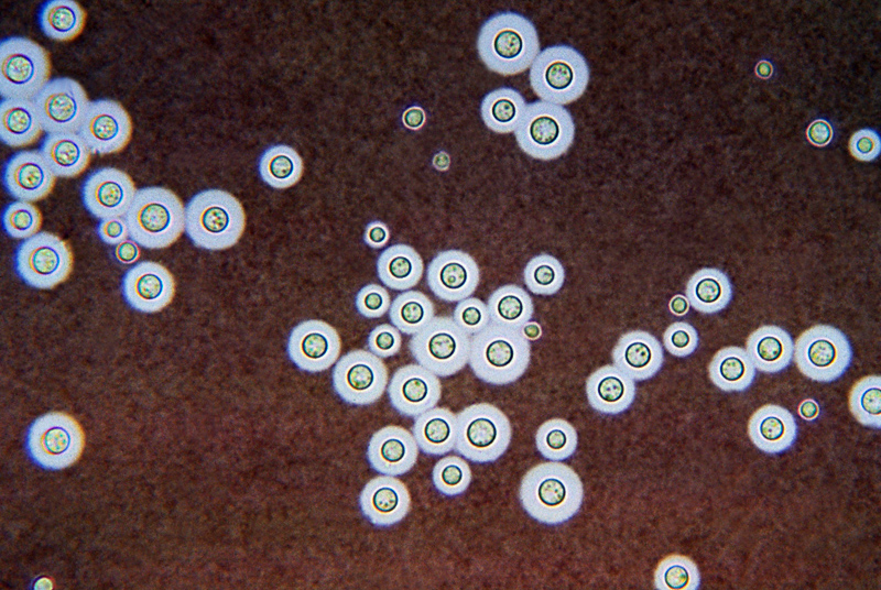 Nấm Cryptococcus neoformans dưới kính hiển vi